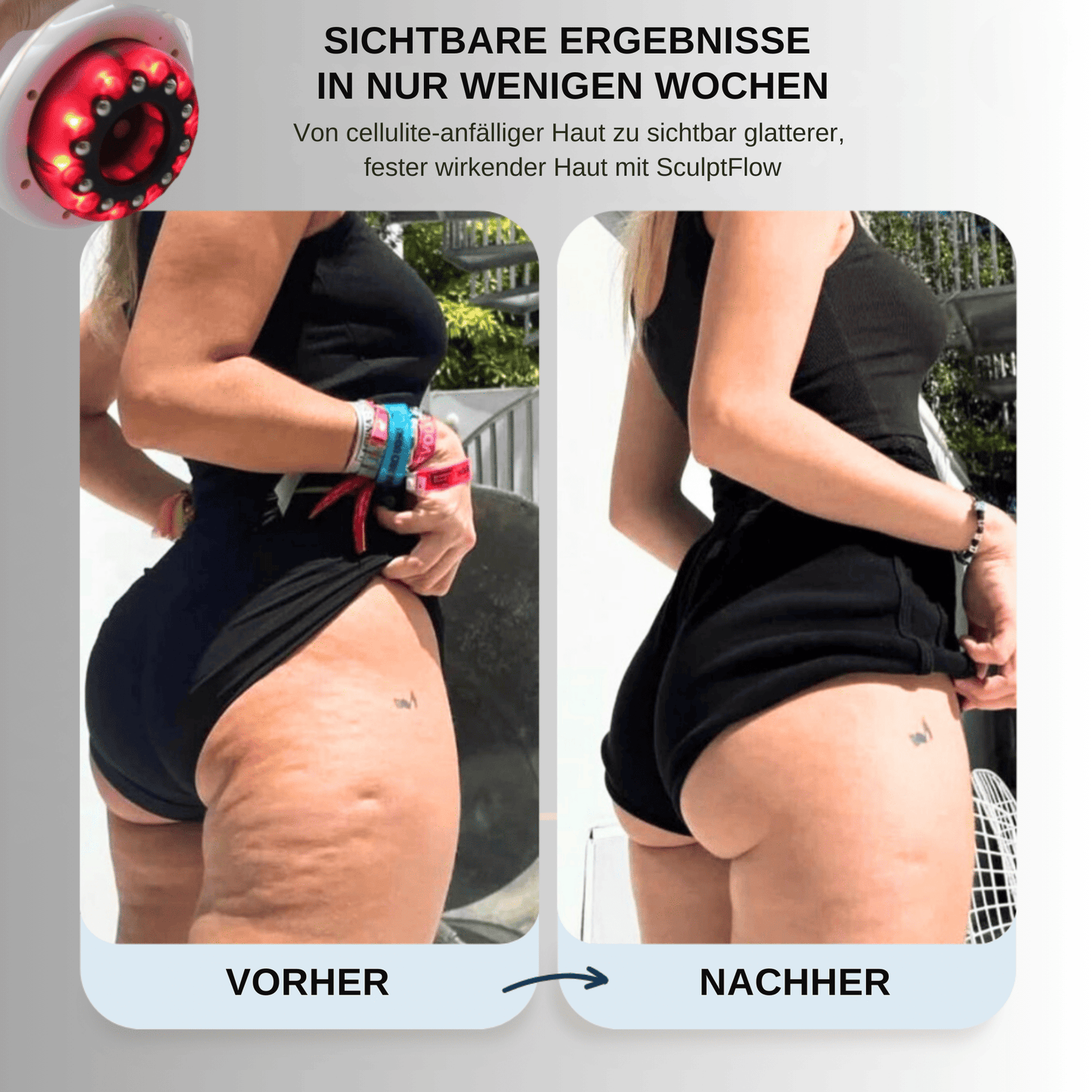 SculptFlow | Tiefenmassage für leichtere Beine & glattere Haut