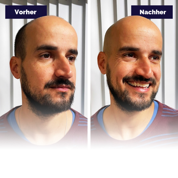 FlexSeries Kit – Alles drin für die perfekte Rasur